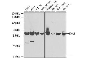 Western blot analysis of extracts of various cell lines using EYA3 Polyclonal Antibody at dilution of 1:1000.