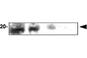 Immunoblot analysis of rat eye extracts were resolved by electrophoresis , transferred to PVDF membrane and probed with CRYAA monoclonal antibody , clone c9F2 (1 : 1000)  . (CRYAA antibody  (AA 1-173))