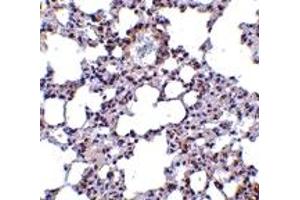 Immunohistochemistry (IHC) image for anti-Transient Receptor Potential Cation Channel, Subfamily C, Member 6 (TRPC6) (N-Term) antibody (ABIN1031645) (TRPC6 antibody  (N-Term))