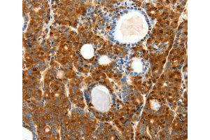 Immunohistochemistry (IHC) image for anti-Secretin Receptor (SCTR) antibody (ABIN1874706) (SCTR antibody)