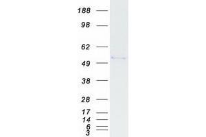 Validation with Western Blot