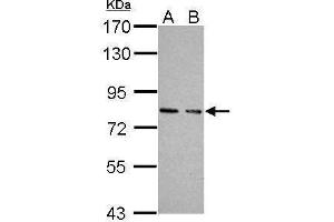 WB Image Sample (30 ug of whole cell lysate) A: JC B: BCL-1 7. (PRKG1 antibody  (Center))