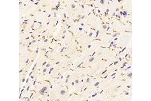 Immunohistochemistry analysis of paraffin-embedded mouse heart using,DSP (ABIN7073719) at dilution of 1: 1000 (Desmoplakin antibody)