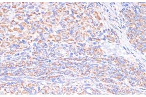 Immunohistochemistry of paraffin-embedded Rat ovary using COX5A Polyclonal Antibody at dilution of 1:100 (40x lens). (COX5A antibody)