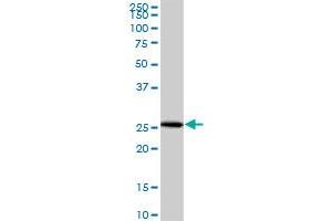NUBP2 MaxPab polyclonal antibody. (NUBP2 antibody  (AA 1-271))