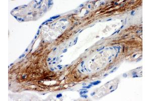 Immunohistochemistry (Paraffin-embedded Sections) (IHC (p)) image for anti-Tenascin XB (TNXB) (AA 3309-3337), (C-Term) antibody (ABIN3043715) (TNXB antibody  (C-Term))