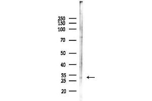 Western blot analysis of lysates from F10-LUC cells(starvation,24h treatment), using Msx2/Hox8 Antibody at 1/1000 dilution.