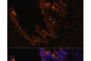 Immunofluorescence analysis of Mouse bronchus cells using KRT7 Polyclonal Antibody at dilution of 1:100. (Cytokeratin 7 antibody)