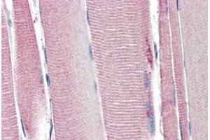 Human Skeletal Muscle (formalin-fixed, paraffin-embedded) stained with UCP2 antibody ABIN461943 at 3.