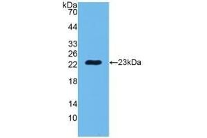 Detection of Recombinant PGLYRP1, Human using Polyclonal Antibody to Peptidoglycan Recognition Protein 1 (PGLYRP1) (PGLYRP1 antibody  (AA 22-196))