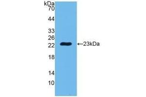 Detection of Recombinant PGLYRP1, Human using Polyclonal Antibody to Peptidoglycan Recognition Protein 1 (PGLYRP1) (PGLYRP1 antibody  (AA 22-196))