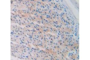 IHC-P analysis of Rat Tissue, with DAB staining. (CKB antibody  (AA 11-367))
