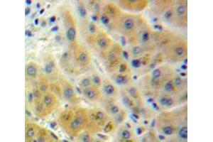Used in DAB staining on fromalin fixed paraffin-embedded Liver tissue (ADH1 antibody  (AA 25-228))