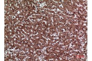 Immunohistochemistry (IHC) analysis of paraffin-embedded Human Liver, antibody was diluted at 1:100. (F11R antibody  (Internal Region))