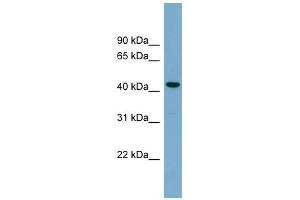 WB Suggested Anti-CDCA7L Antibody Titration: 0. (CDCA7L antibody  (Middle Region))
