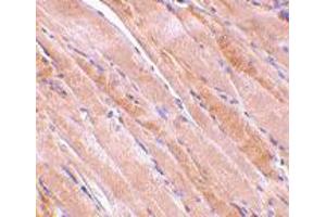 Immunohistochemistry of EMD in human skeletal muscle tissue with EMD polyclonal antibody  at 2.