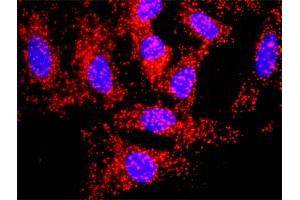 Proximity Ligation Analysis of protein-protein interactions between TGFB1 and APP. (APP antibody  (AA 19-305))