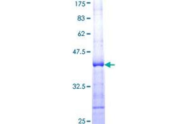 PRDM2 Protein (AA 1606-1705) (GST tag)