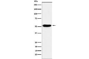 Western blot analysis of IRF4 expression in Ramos cell lysate.