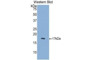 WB of Protein Standard: different control antibodies against Highly purified E. (Cathepsin D ELISA Kit)