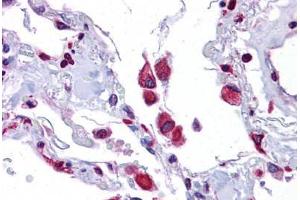 Human Lung: Formalin-Fixed, Paraffin-Embedded (FFPE) (EIF2AK1 antibody  (AA 108-157))