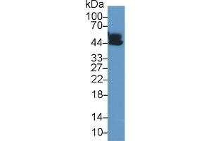 Detection of a1AGP in Human Lung lysate using Polyclonal Antibody to Alpha-1-Acid Glycoprotein (a1AGP) (ORM1 antibody  (AA 19-201))