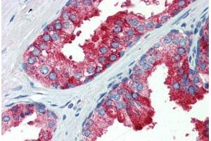 Human Prostate (formalin-fixed, paraffin-embedded) stained with YAP1 antibody ABIN462247 followed by biotinylated goat anti-rabbit IgG secondary antibody ABIN481713, alkaline phosphatase-streptavidin and chromogen. (YAP1 antibody  (AA 351-400))