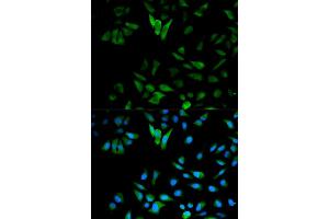 Immunofluorescence analysis of HeLa cells using ENO1 antibody. (ENO1 antibody)
