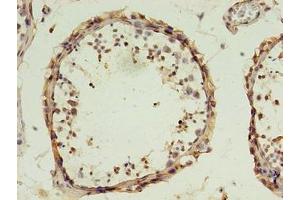 Immunohistochemistry of paraffin-embedded human testis tissue using ABIN7149824 at dilution of 1:100 (DPPA4 antibody  (AA 11-264))