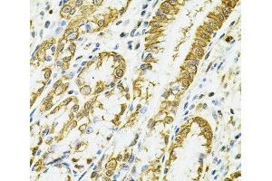 Immunohistochemistry of paraffin-embedded Human esophagus using HLA-DQA1 Polyclonal Antibody at dilution of 1:100 (40x lens). (HLA-DQA1 antibody)