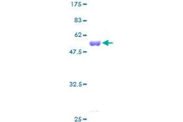 PMM2 Protein (AA 1-246) (GST tag)