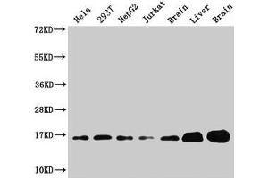 Western Blot Positive WB detected in: Hela whole cell lysate, 293T whole cell lysate, HepG2 whole cell lysate, Jurkat whole cell lysate, Rat brain tissue, Rat liver tissue, Mouse brain tissue All lanes: Sod1 antibody at 3 μg/mL Secondary Goat polyclonal to rabbit IgG at 1/50000 dilution Predicted band size: 16 kDa Observed band size: 16 kDa (SOD1 antibody  (AA 2-154))