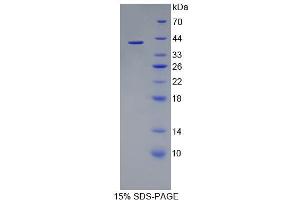 Image no. 1 for Phosphodiesterase 1A (PDE1A) (AA 2-318) protein (His tag) (ABIN4990448)