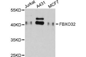 Western blot analysis of extracts of various cell lines, using FBXO32 antibody (ABIN2562558) at 1:1000 dilution. (FBXO32 antibody)