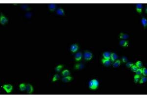 Immunofluorescence staining of PC-3 cells with ABIN7171386 at 1:53, counter-stained with DAPI. (CD3 epsilon antibody  (AA 23-207))