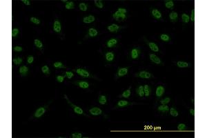 Immunofluorescence of monoclonal antibody to SMAD5 on HeLa cell. (SMAD5 antibody  (AA 105-182))