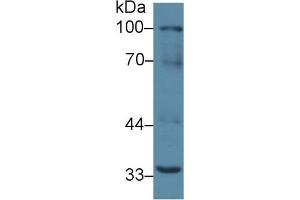 Western blot analysis of Mouse Liver lysate, using Mouse RANk Antibody (2 µg/ml) and HRP-conjugated Goat Anti-Rabbit antibody (