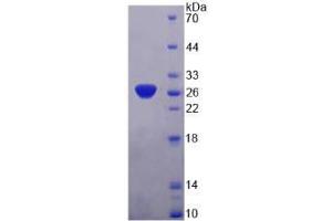 SDS-PAGE analysis of SNAP25 Protein. (SNAP25 Protein)