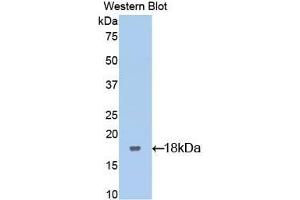 Detection of Recombinant LIFR, Rat using Polyclonal Antibody to Leukemia Inhibitory Factor Receptor (LIFR) (LIFR antibody  (AA 151-290))