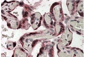 Image no. 1 for anti-Iduronate 2-Sulfatase (IDS) (Internal Region) antibody (ABIN375037) (IDS antibody  (Internal Region))