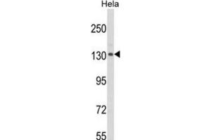 Western Blotting (WB) image for anti-CAP-GLY Domain Containing Linker Protein 1 (CLIP1) antibody (ABIN3003978) (CLIP1 antibody)