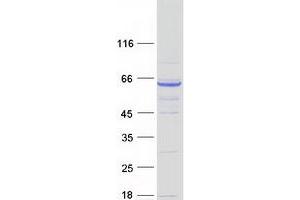 Validation with Western Blot (LRRC48 Protein (Transcript Variant 2) (Myc-DYKDDDDK Tag))