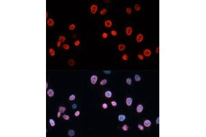 Immunofluorescence analysis of HeLa cells using CDKN1A/p21CIP1 antibody (ABIN3022005, ABIN3022006, ABIN3022007 and ABIN6218565) at dilution of 1:100. (p21 antibody  (AA 43-142))