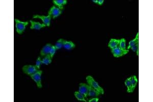 Immunofluorescence staining of HepG2 cells with ABIN7139751 at 1:100, counter-stained with DAPI. (CAMK2N1 antibody  (AA 9-27))