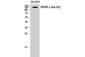 Western Blotting (WB) image for anti-Platelet Derived Growth Factor Receptor alpha (PDGFRA) (Thr210) antibody (ABIN3176813) (PDGFRA antibody  (Thr210))