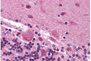 Human Brain, Cerebellum (formalin-fixed, paraffin-embedded) stained with FYN antibody ABIN214218 at 15 ug/ml followed by biotinylated anti-mouse IgG secondary antibody ABIN481714, alkaline phosphatase-streptavidin and chromogen.