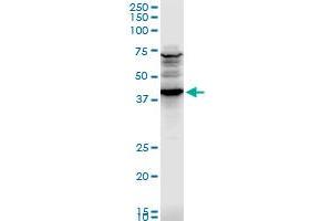 CADM1 polyclonal antibody (A01), Lot # UOZ1060607QCS1. (CADM1 antibody  (AA 151-250))