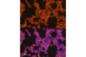 Immunofluorescence analysis of Jurkat cells using Oncostatin M Rabbit mAb (ABIN7269099) at dilution of 1:100 (40x lens). (Oncostatin M antibody)