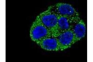 Confocal immunofluorescent analysis with HepG2 cell using PLA2G6  Antibody , followed by Alexa Fluor® 488-conjugated goat anti-rabbit lgG (green). (PLA2G6 antibody  (Middle Region))