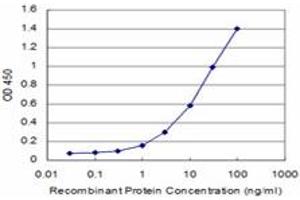 Detection limit for recombinant GST tagged CARF is approximately 1ng/ml as a capture antibody. (CDKN2AIP antibody  (AA 1-579))